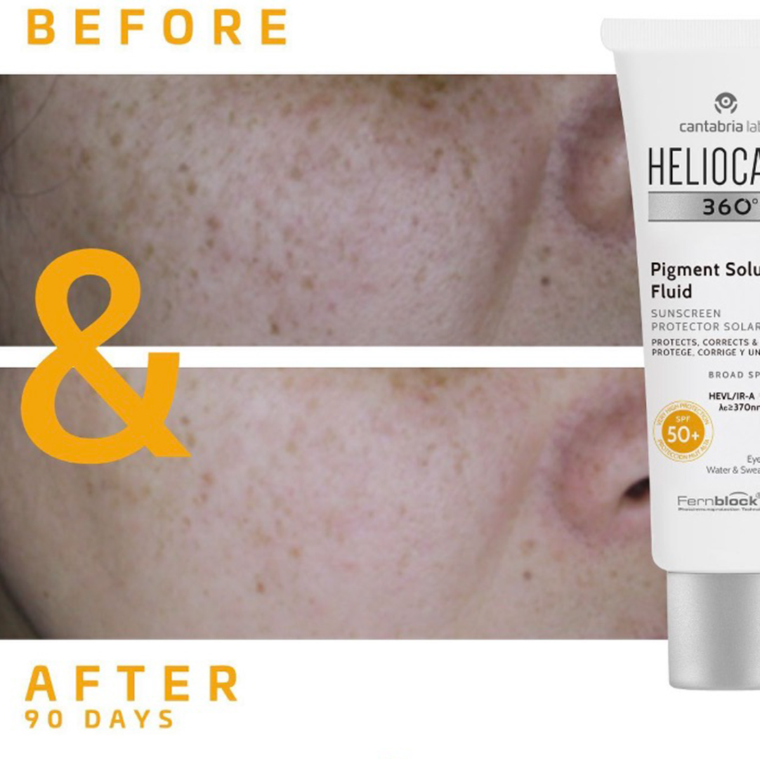 Heliocare 360° Pigment Solution Fluid SPF 50