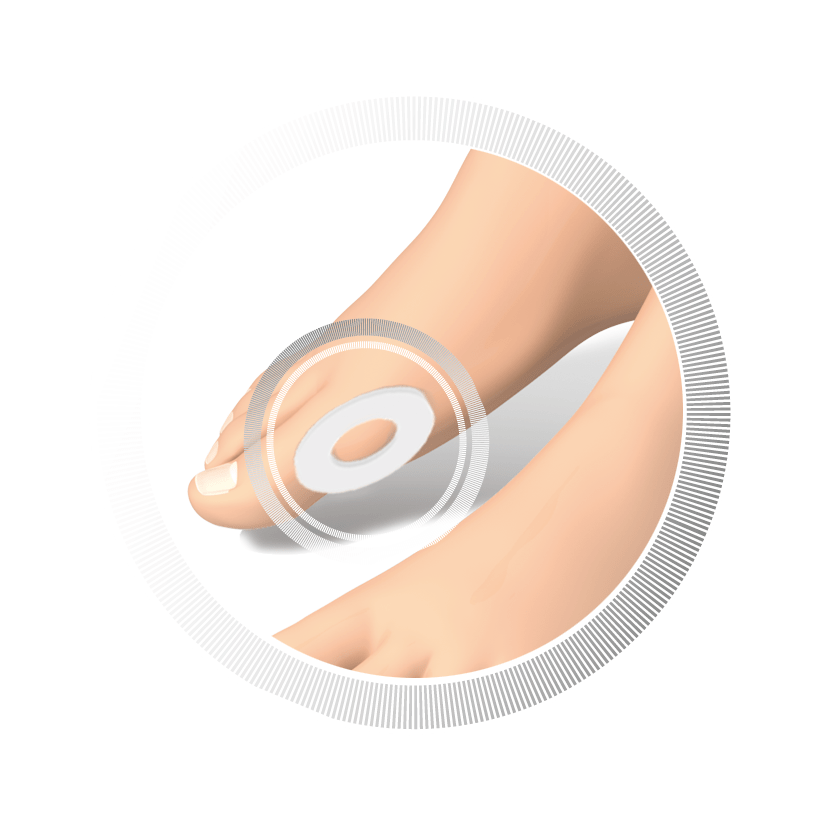 RUCK® AVLASTNING Basic Hallux Valgus-ring, oval (40 styck) - 3