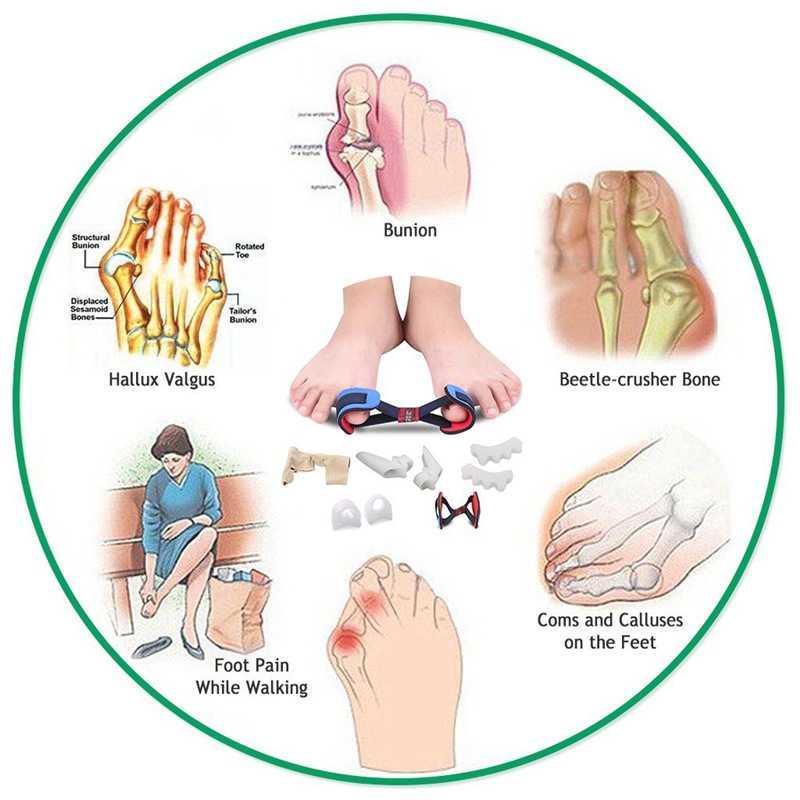 Hallux Valgus - Korrigeringsset Tår 9 delar - 13
