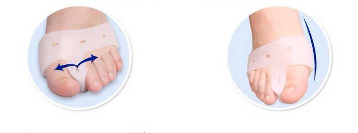 Hallux Valgus Protection - Soft Forefoot 2 pcs - 3