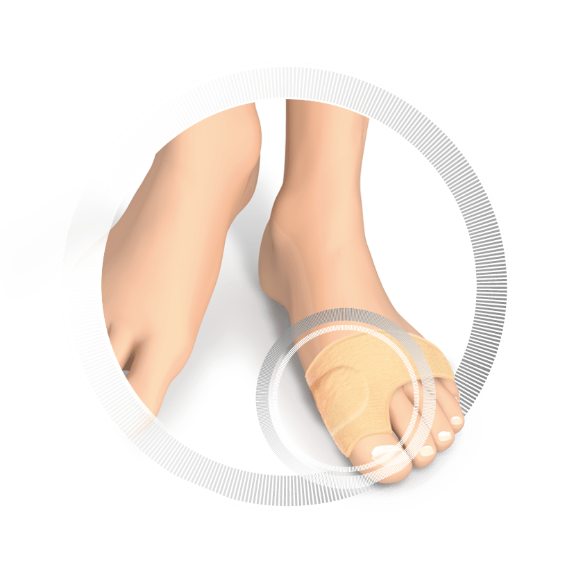 RUCK® AVLASTNING Smartgel, Hallux-Valgus skydd (liten), 2 st - 3