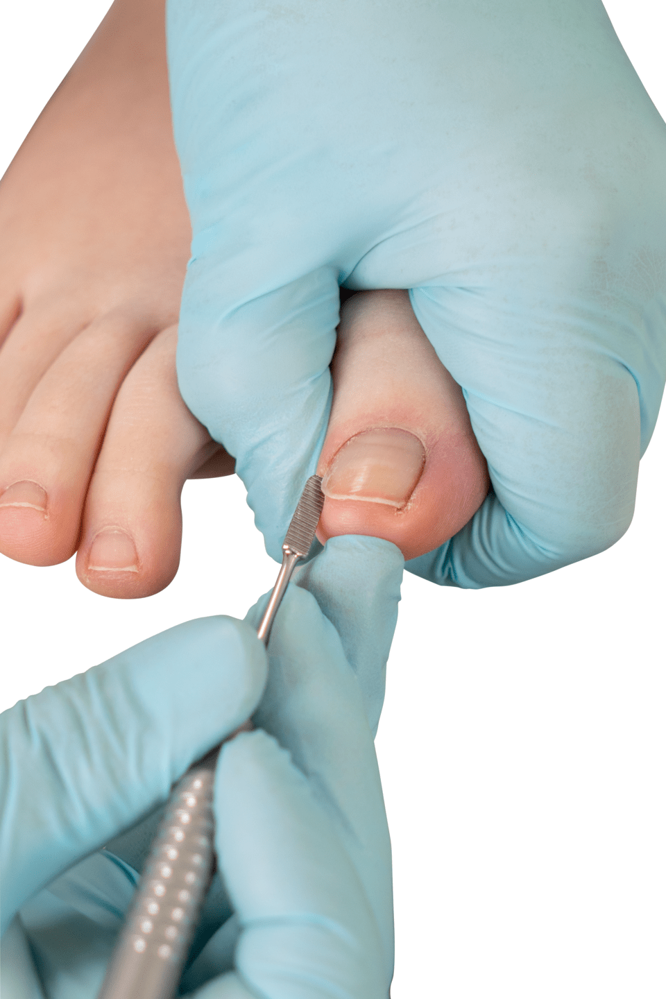 RUCK® INSTRUMENT Nagelinstrument, dubbelsidig - lättvikt - 5