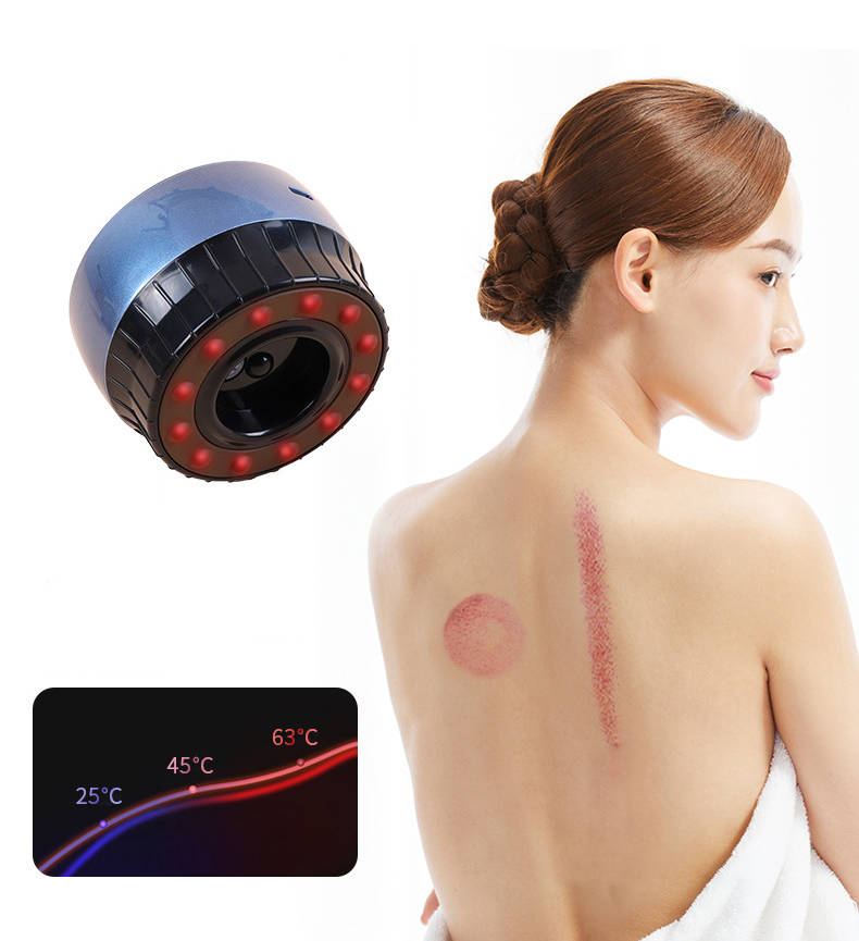 Electronic Cupping Therapy Massager - Rechargable - 5