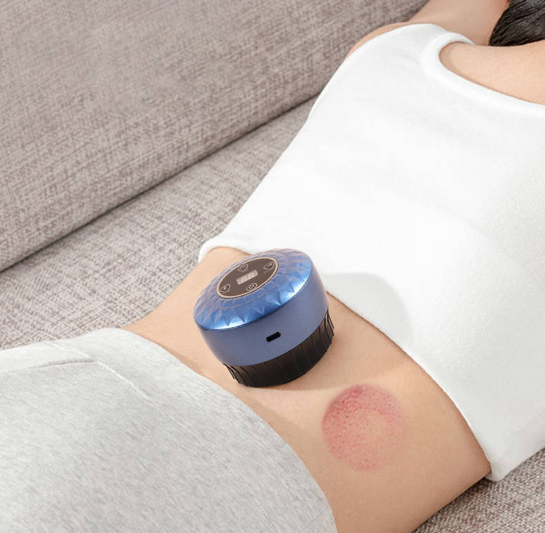 Electronic Cupping Therapy Massager - Rechargable - 4