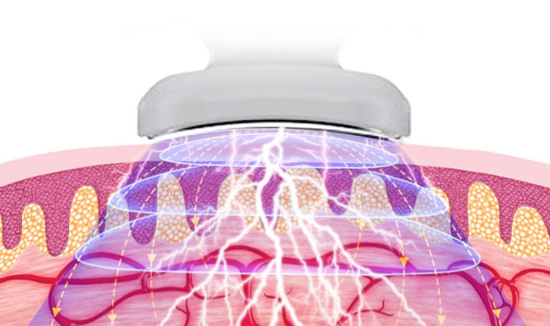 Nackmassör - Electric Pulse Neck Massager - 4