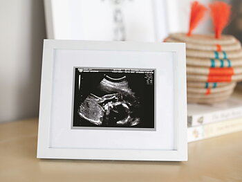 Pearhead Sonogram Frame small  (no text)