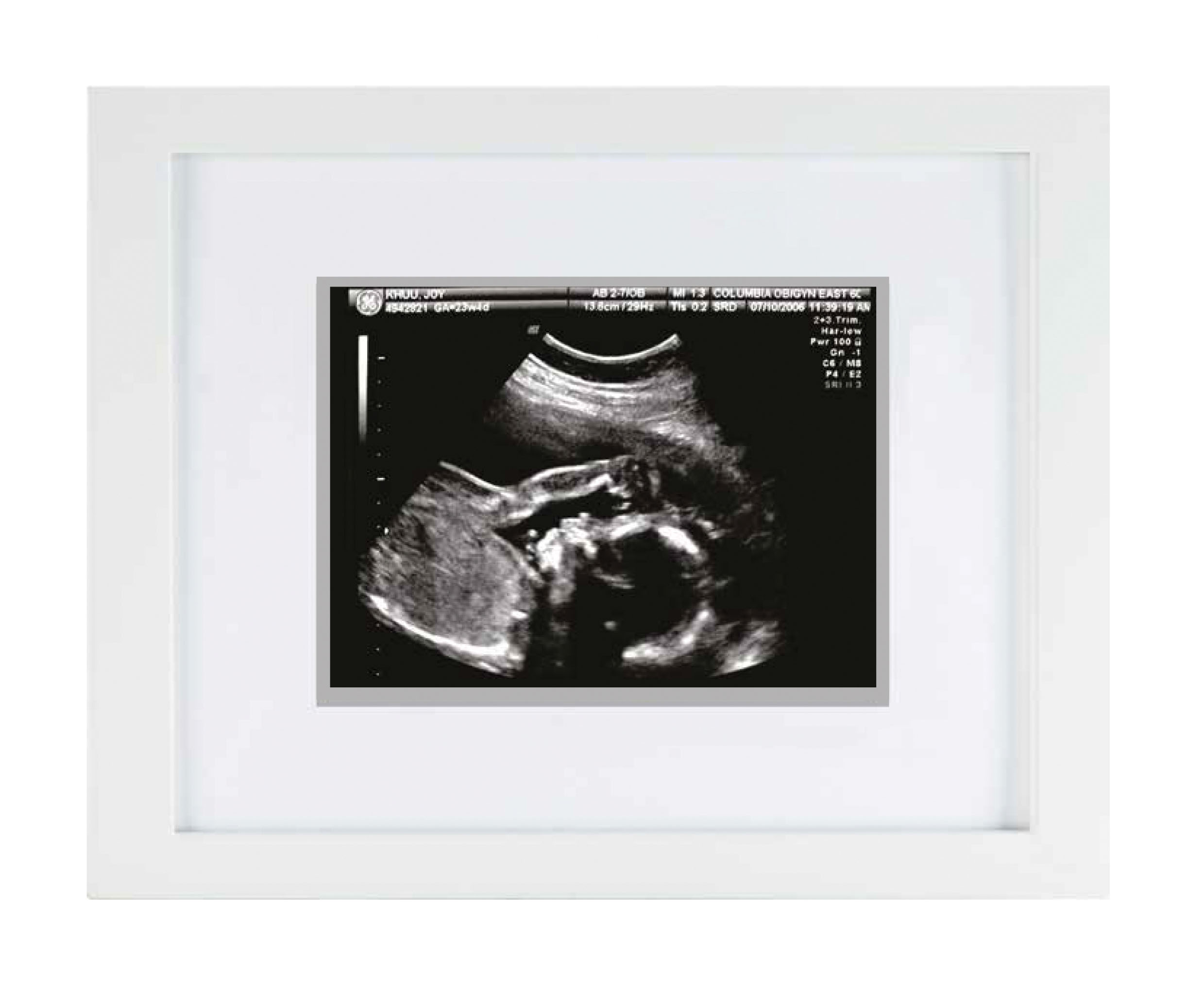 Pearhead Sonogram Frame small  (no text)
