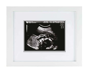 Pearhead Sonogram Frame small  (no text)