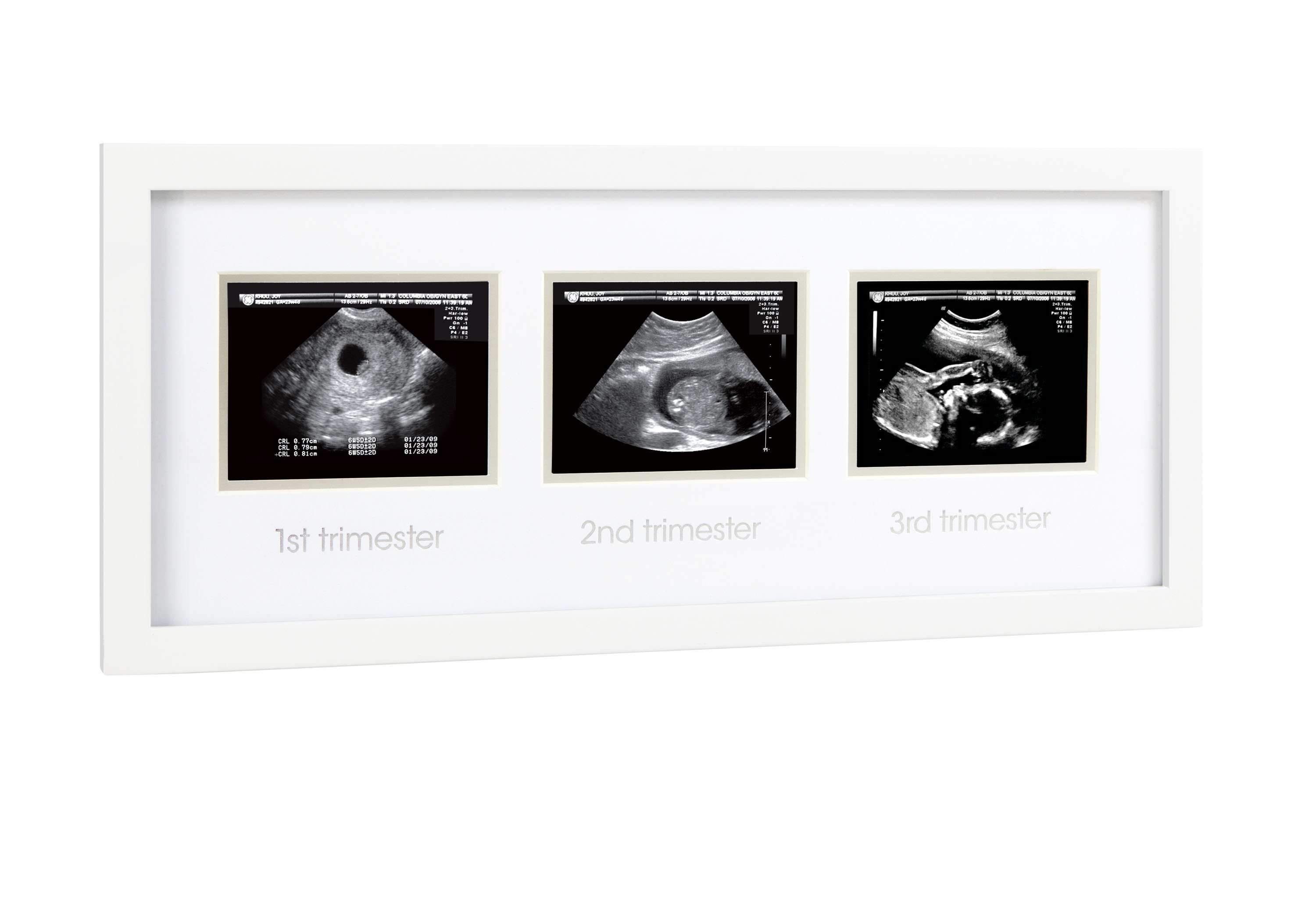 Pearhead Trimester Sonogram Frame - 5