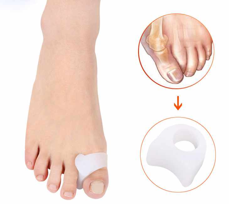 Toe Dividers - Forefoot Toe 2-pack - 2