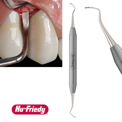 Hu-Friedy® PM Prodigy Surgical Curette, Kort 