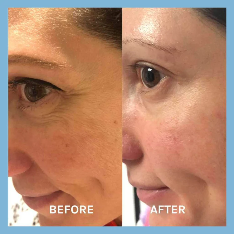 EVOLVE Age Defying Lifting Serum 30ml - 6