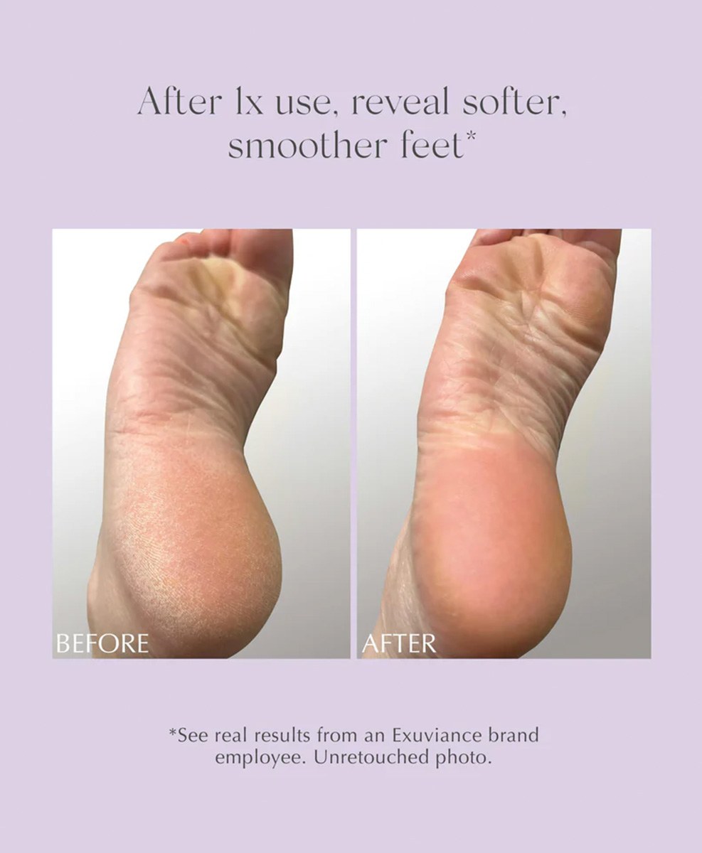 Exuviance Exfoliating & Conditioning Foot Balm  - 8