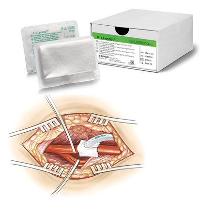 Lyostypt®  Local Hemostatic Agent 3 x 5 cm, 12St.