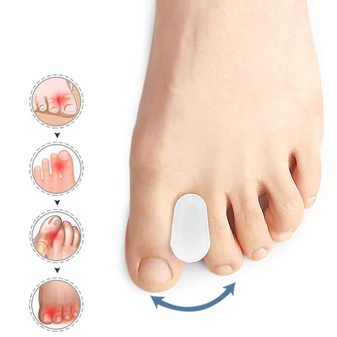 Tåspridare vid hallux valgus - 2 st - Separerar tårna för att minska smärta