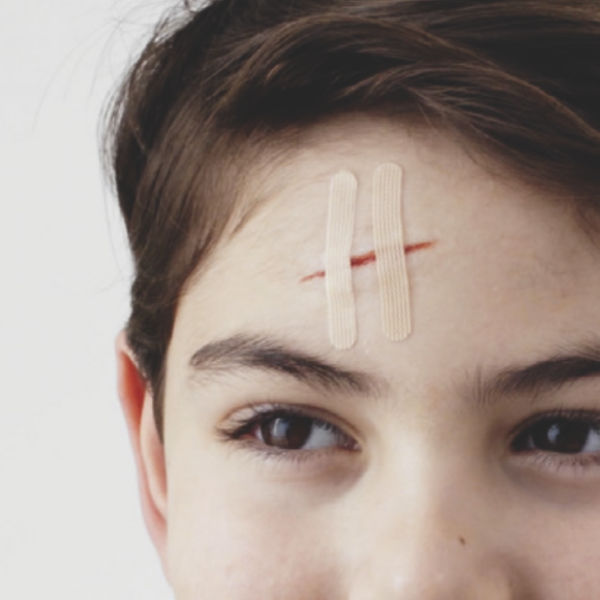 Leukoplast Wound Closure Strip - 3