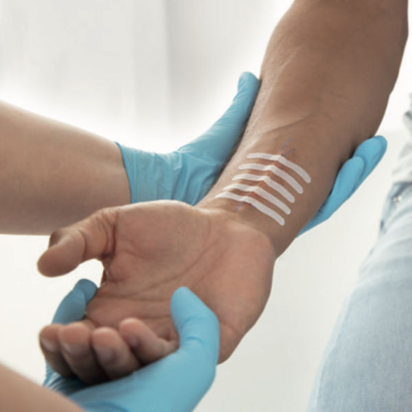 Leukoplast Wound Closure Strip - 4