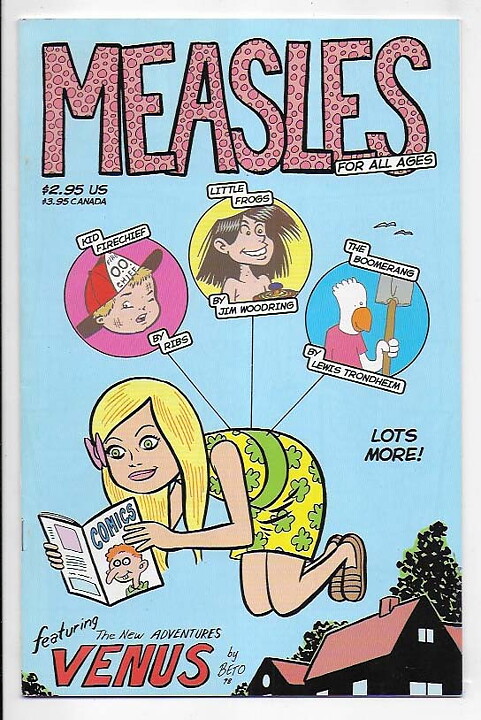 Measles # 1 NM- Hernandez 1st Issue