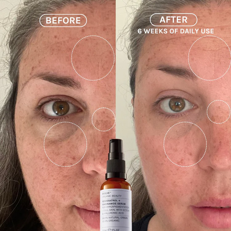 EVOLVE Resveratrol + Niacinamide Serum 30ml - 3