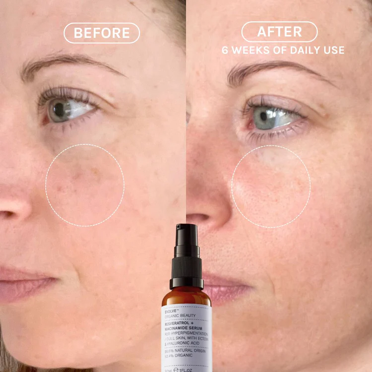 EVOLVE Resveratrol + Niacinamide Serum 30ml - 2
