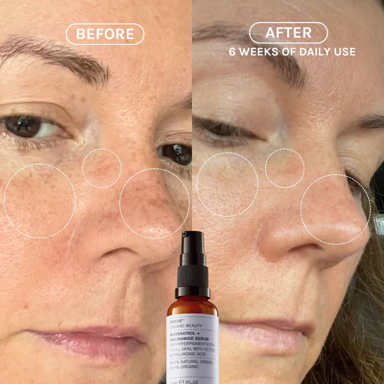 EVOLVE Resveratrol + Niacinamide Serum 30ml - 4