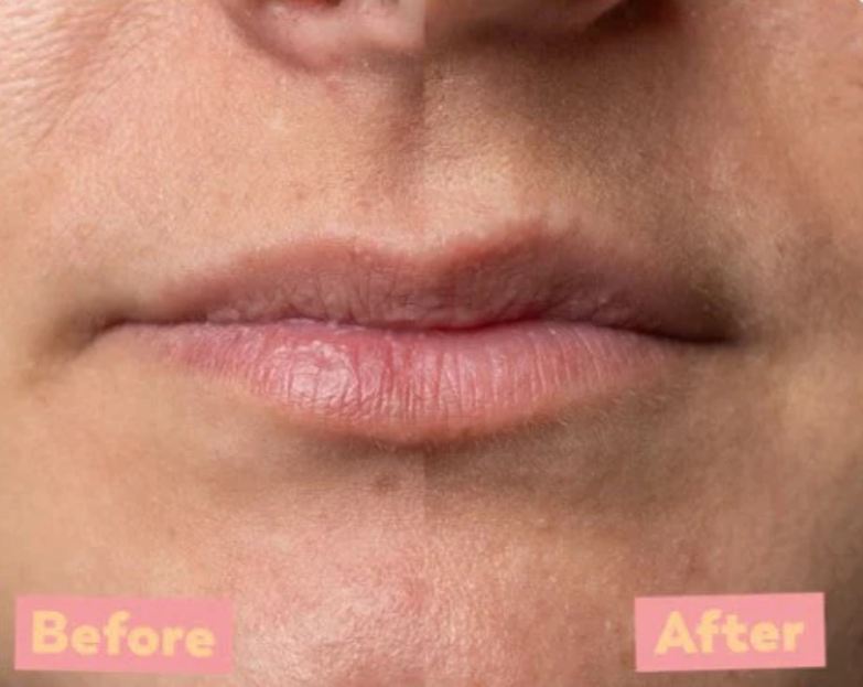 TREW Peel lip , läppskrubb - 3