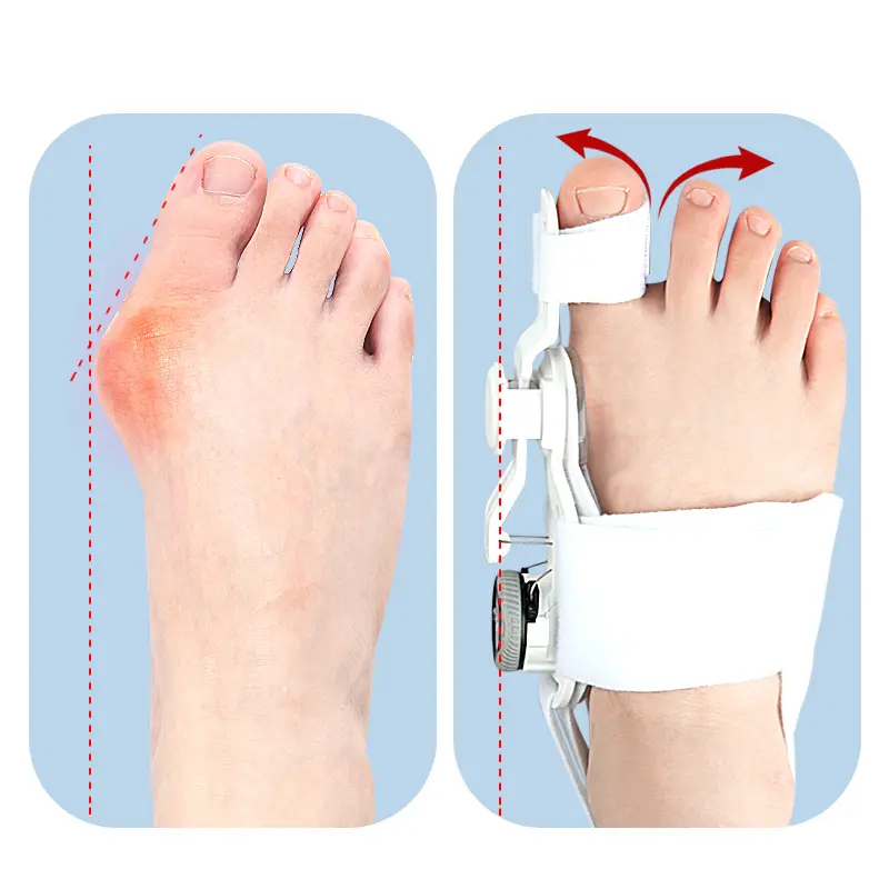 Justerbar nattspjälk för Hallux Valgus - 3