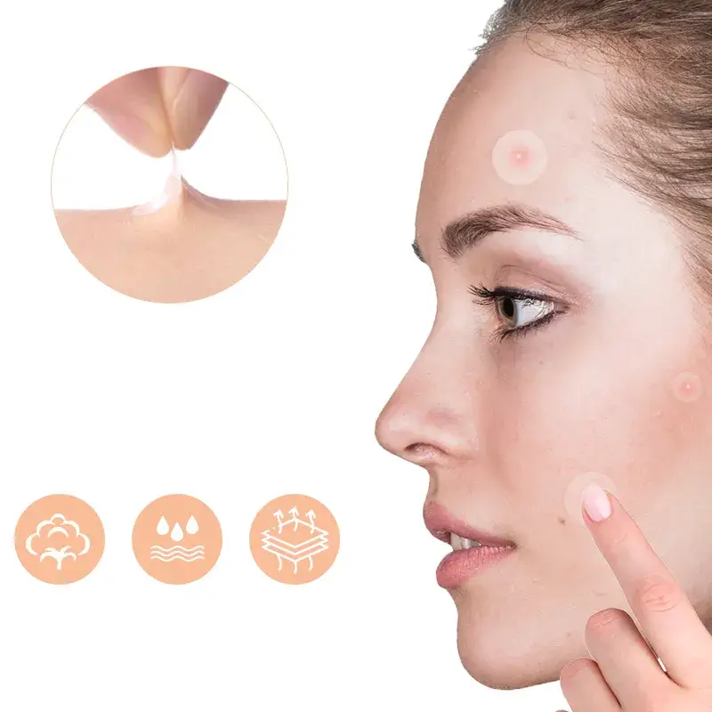 Acne pleisters – Pimple Patch - 2