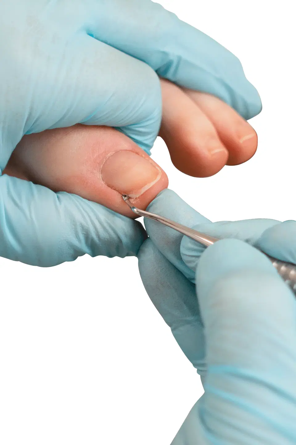 RUCK® INSTRUMENT Nagelinstrument lättvikt, sked dubbelsidig - 4