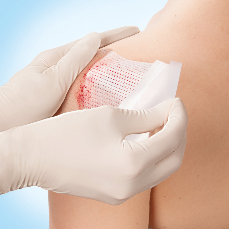 Cuticell® Contact - 3