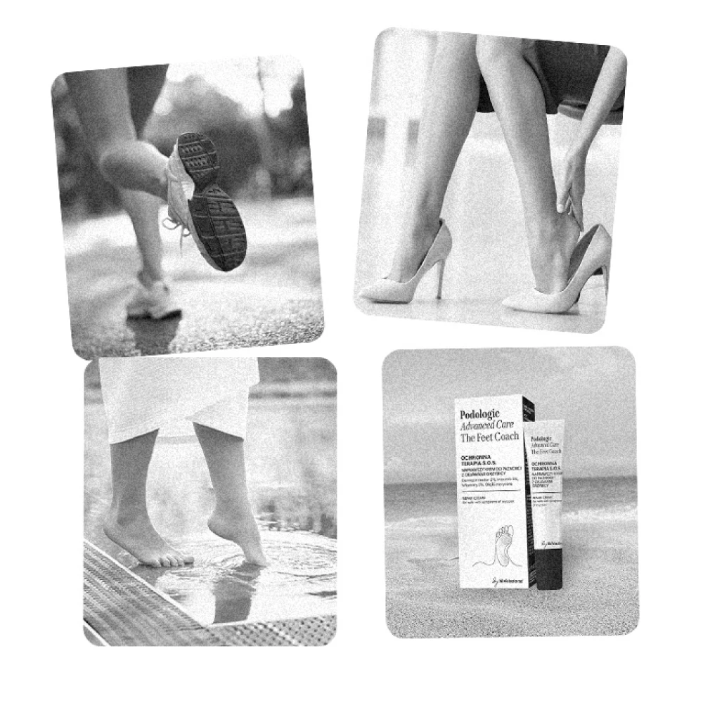 Nagelcrème voor nagels met schimmelsymptomen - 3