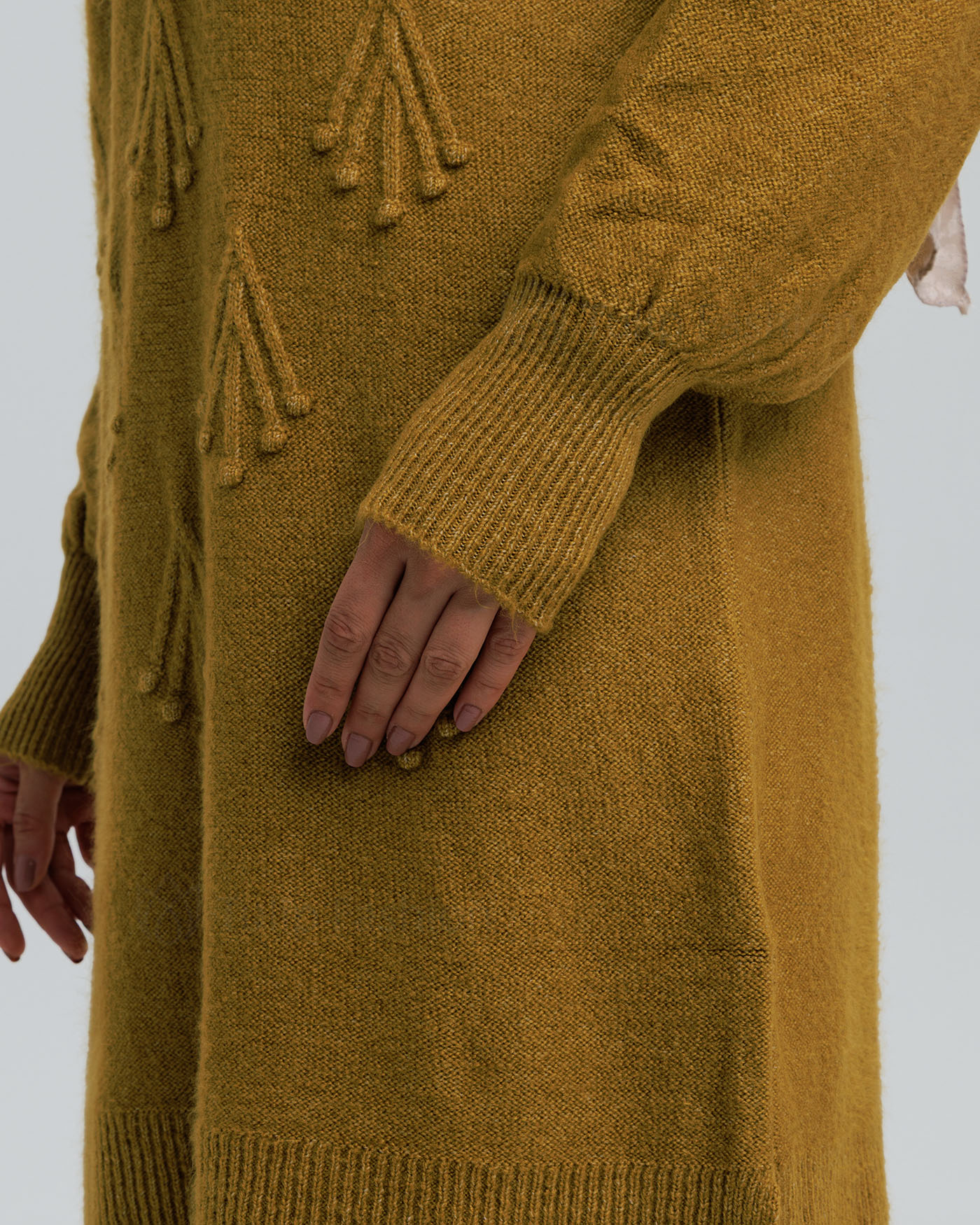 Tunic - Mustard - 6