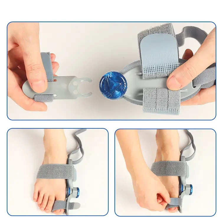 Hallux valgus-korrigerare med justerbart vred - 3