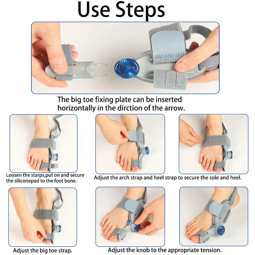 Hallux valgus-korrigerare med justerbart vred - 6