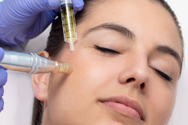 Derma Meso Pen – Microneedling Pen 10 R-Nano Spetsar - 3