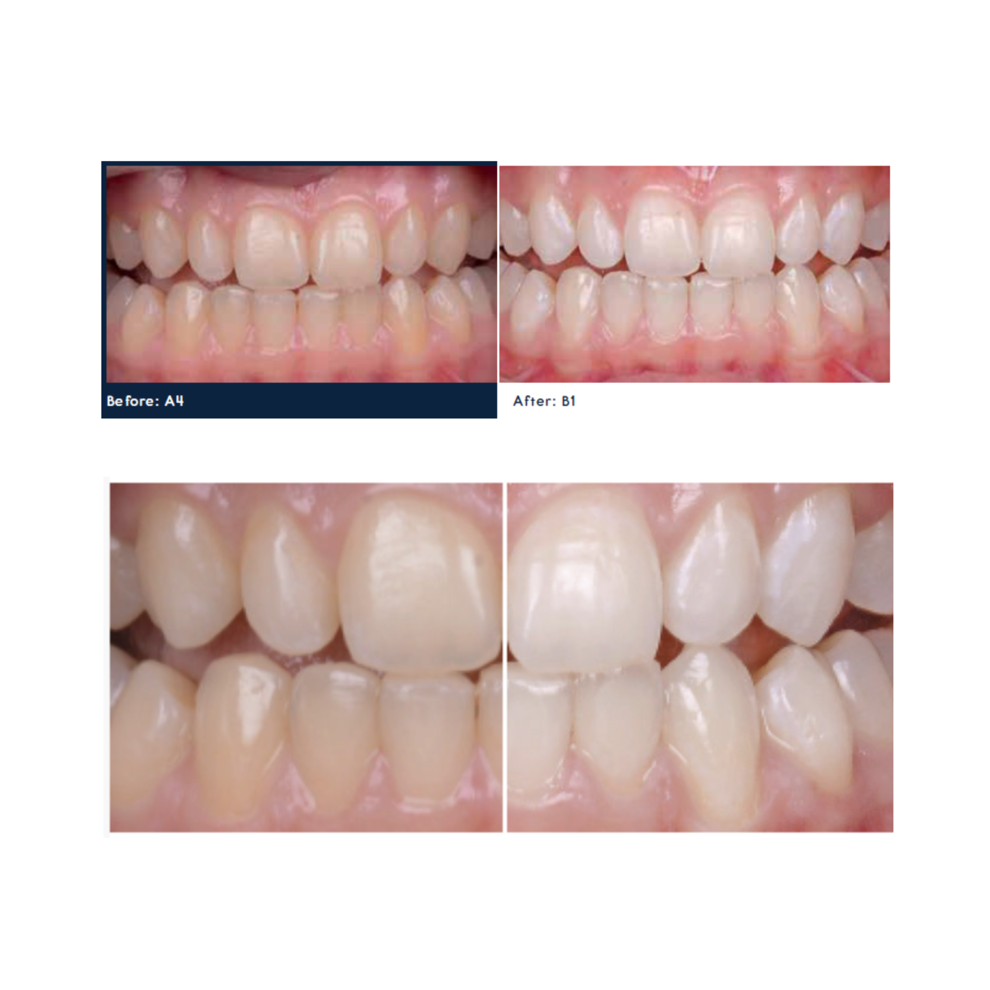  Bite & White ABC Masterkit - 3