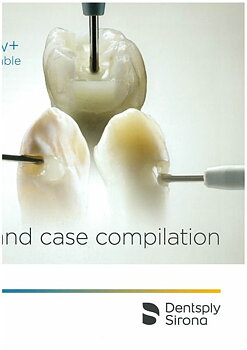 SDR Study and case compilation