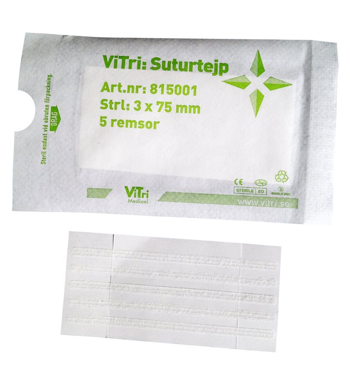 Suturtejp, ViTri