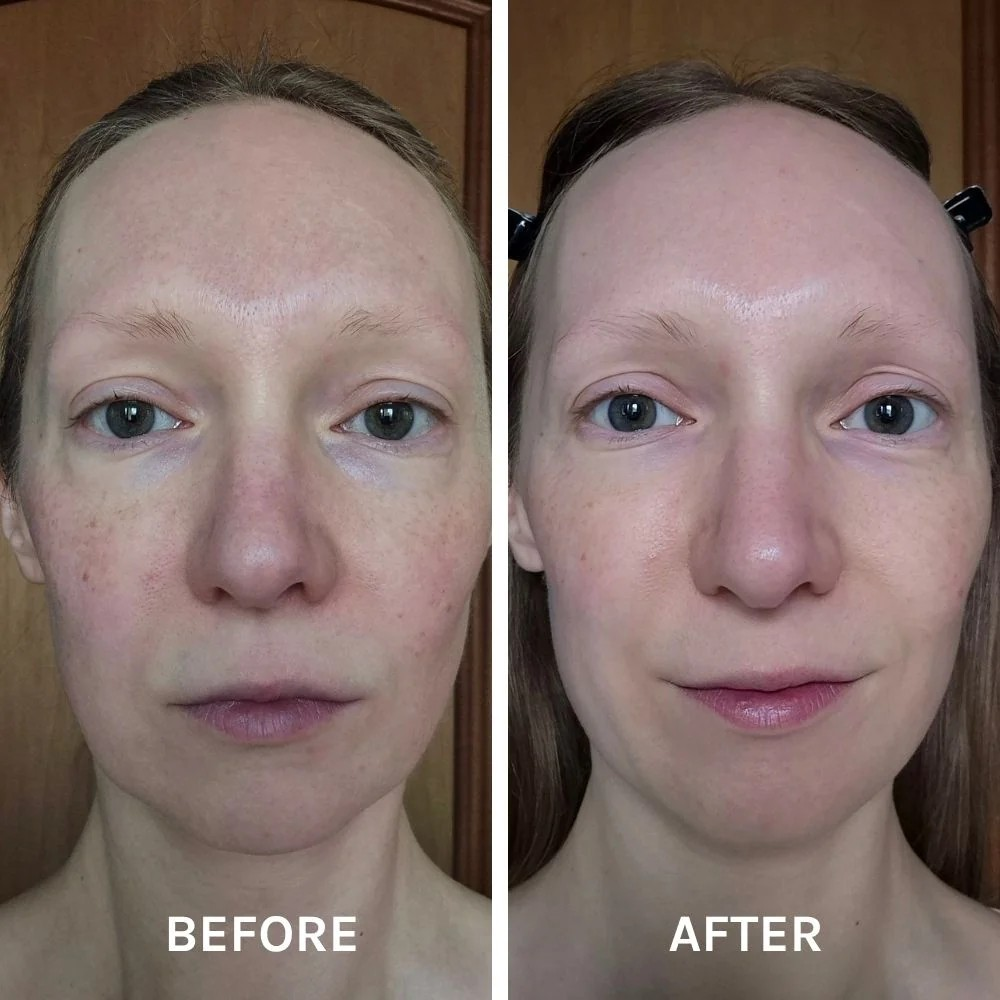EVOLVE EGF + Collagen Renewal Booster 15ml - 2