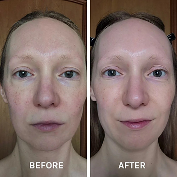 EVOLVE EGF + Collagen Renewal Booster 15ml