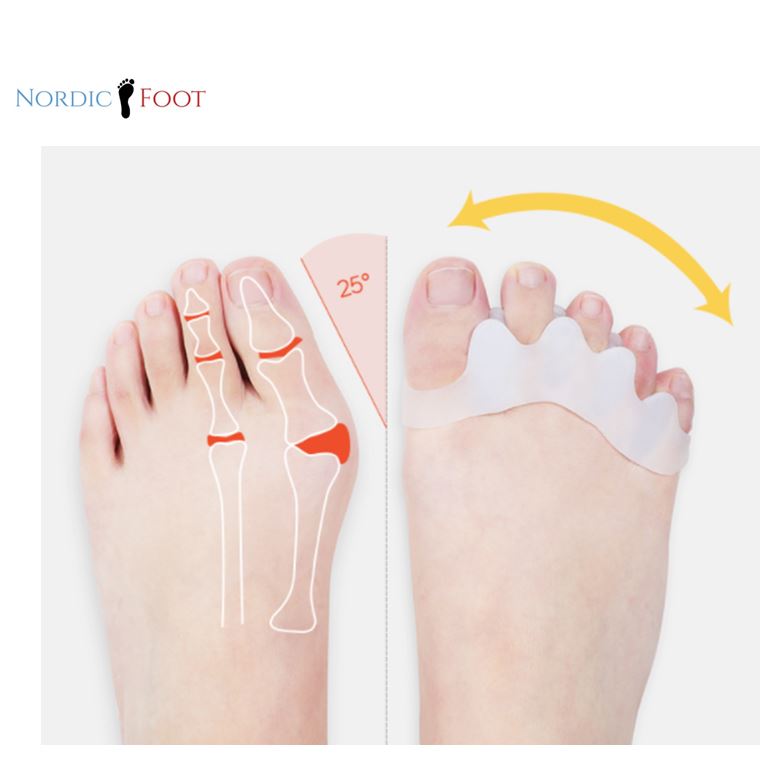 Hallux-valgus-Silikonprotektor - 2