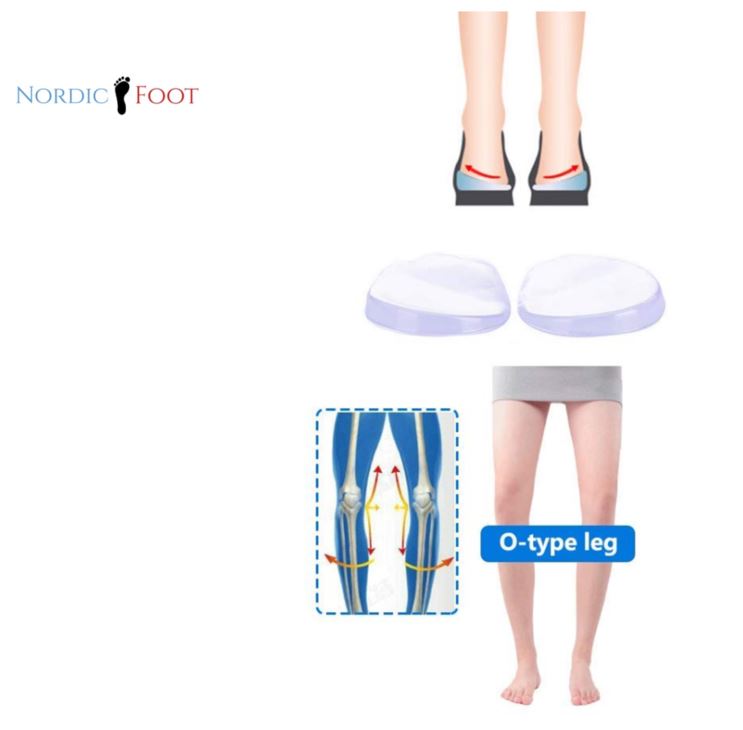 Semelles à talon pour jambes arquées - 4