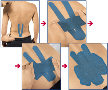 Leukotape K - 7,5 cm - 3