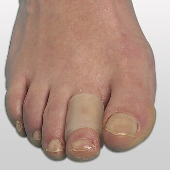 Gel-ring, ren