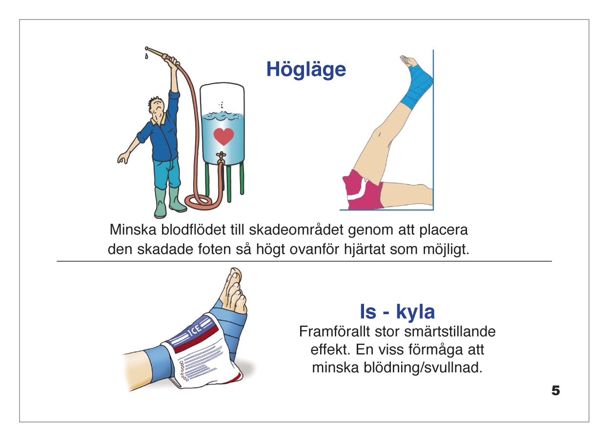 Häfte: Fotledsstukning - 3