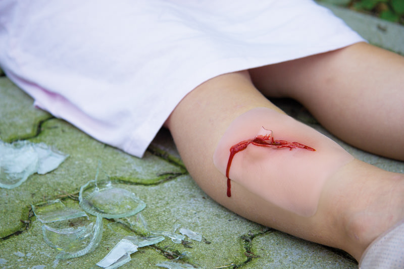 Sårmoulage - Kutt med glass - 5