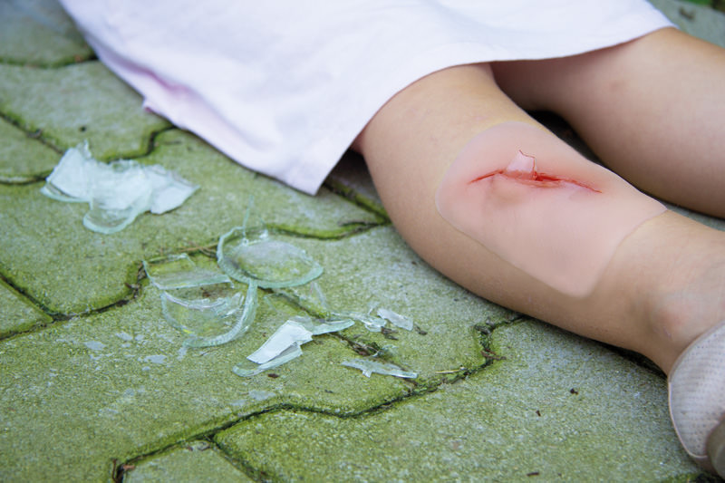 Sårmoulage - Kutt med glass - 4