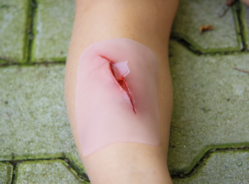 Sårmoulage - Kutt med glass - 3