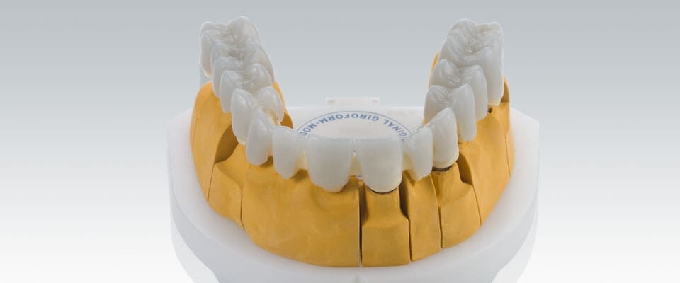 CAD/CAM material - Denthouse AB