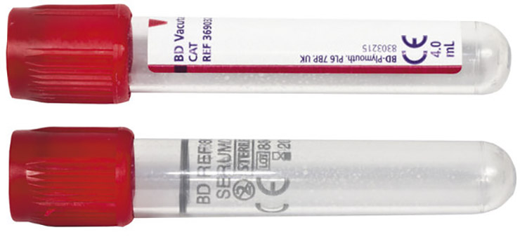 NÄYTEPUTKI VACUTAINER SEERUMI TR /100 - 2